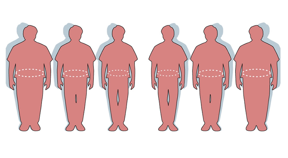 Obesitas - Illustratie: Keimp
